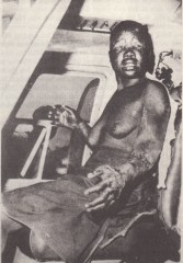 Zimbabwe